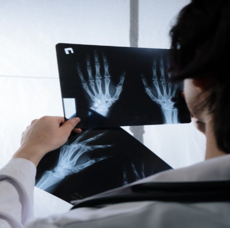 public transportation accident